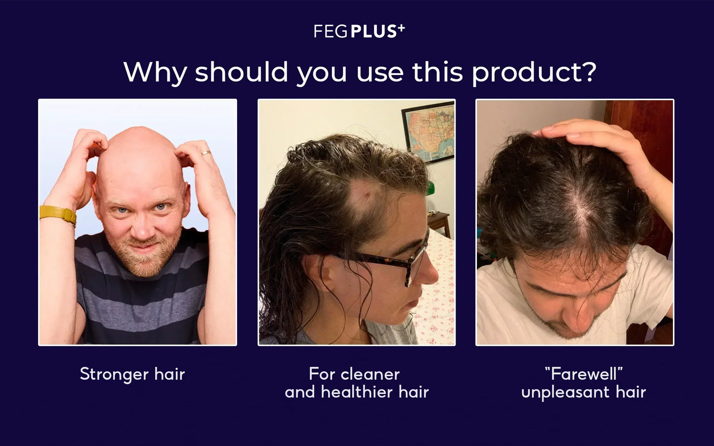 FEG Plus Hair Growth Spry